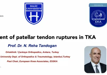 Repair/reconstruction of patellar tendon rupture in TKA