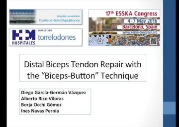 Distal biceps reinsertion using the 'biceps-button' technique