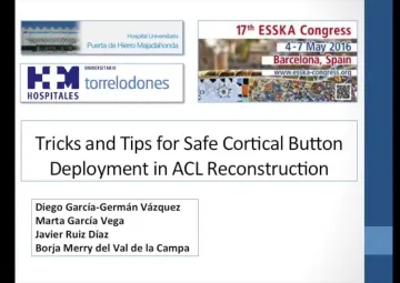 Tricks and Tips for Safe Cortical Button Deployment in ACL Reconstruction