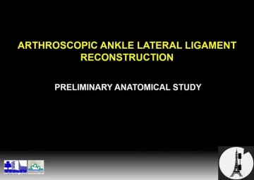 Anatomical basis of arthroscopic lateral ligament reconstruction