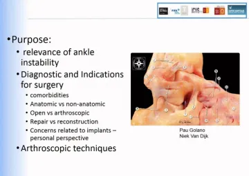 Arthroscopic techniques of lateral ligament reconstruction