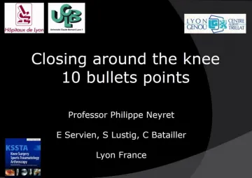 10 bullet points of high tibial osteotomy - Medial opening vs. lateral closing