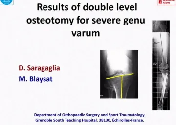 Double level osteotomies: An emerging concept