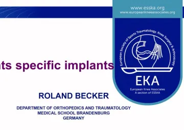 Patients matched implants