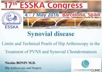 Synovial disease - Limits and technical pearls of hip arthroscopy in the treatment of PVNS and synovial chondromatosis