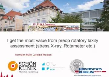 I get the most value from preoperative rotatory laxity assessment (stress XR, rotameter, etc)