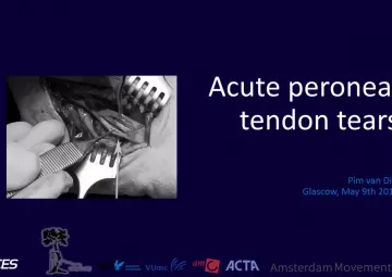 Background to acute peroneal tears and optimal management according to literature