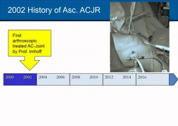 AC-Joint instability in the athlete - current treatment algorithm