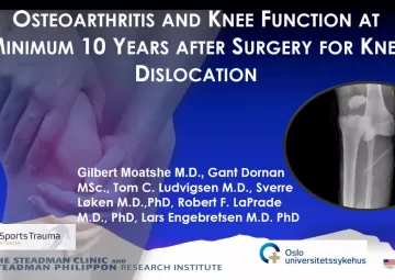 Does a knee dislocation lead to OA? 10 years after 100 dislocations