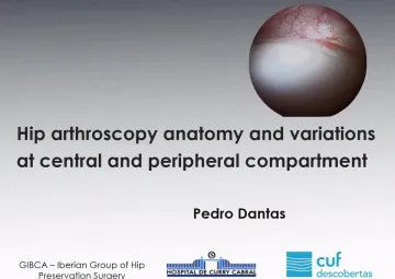 Hip arthroscopy anatomy and variations at central and peripheral compartment