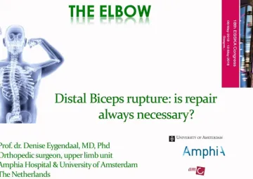 Introduction: Rupture of the distal biceps; is a repair always necessary?