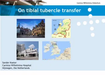 Is there still a role for tibial tubercle transfer?