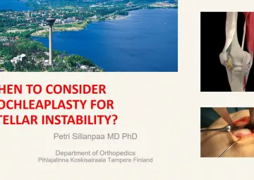 When to consider trochleaplasty for patellar instability