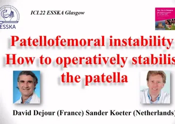 Patellofemoral instability: How to operatively stabilise the patella