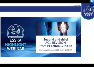 Second and Third ACL REVISION from PLANNING to OR