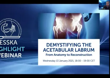 Demystifying the Acetabular Labrum: From Anatomy to Reconstruction