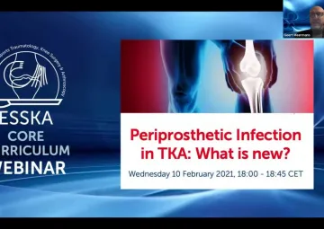 Periprosthetic Infection in TKA: What is new?