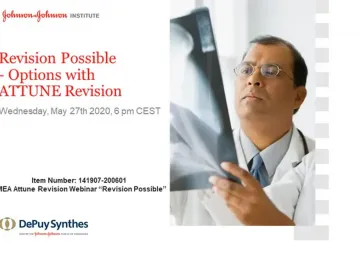 Webinar: Options with ATTUNE Revision