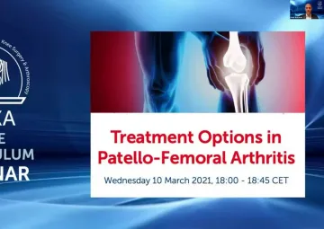 Treatment Options in Patello-Femoral Arthritis