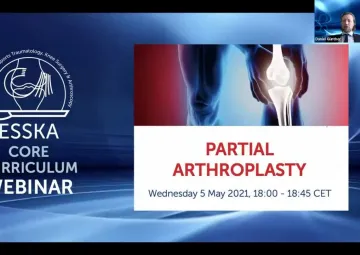 PARTIAL ARTHROPLASTY