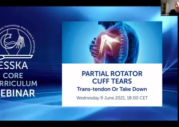 PARTIAL ROTATOR CUFF TEARS: Trans-tendon or Take Down