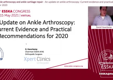 An update on ankle arthroscopy: Current evidence and practical recommendations for 2020