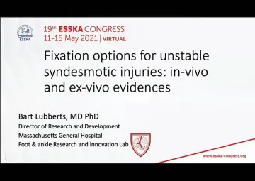 Fixation options for unstable syndesmotic injuries: in-vivo and ex-vivo evidences - 12'