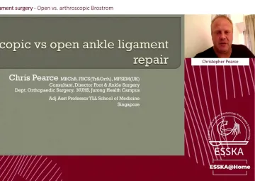 Open vs. arthroscopic Brostrom