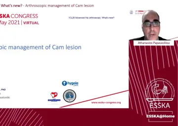 Arthroscopic management of Cam lesion