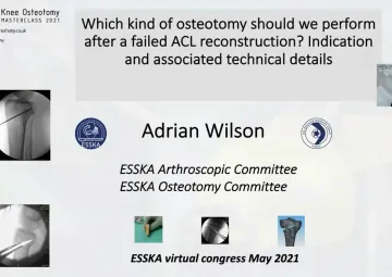 Osseous abnormalities: Which kind of osteotomy should we perform after a failed ACL reconstruction? Indication and associated technical details