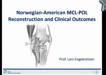 Norwegian-American MCL-POL reconstruction and clinical outcomes