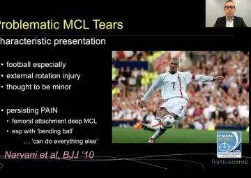 Deep MCL injury in footballers