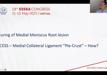 Suturing of medial meniscus root lesion - How do I do that and why?