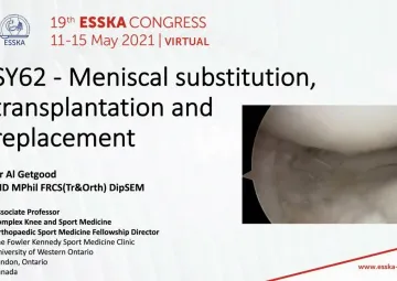 Meniscal substitution, transplantation and replacement