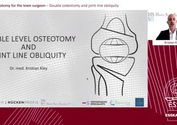 Double osteotomy and joint line obliquity