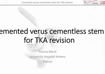 Cemented versus uncemented stems