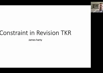 When to choose which constraint in revision TKA?