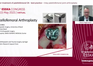 Inlay patellofemoral joint arthroplasty