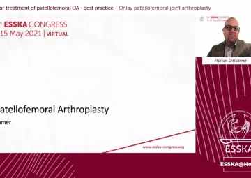 Onlay patellofemoral joint arthroplasty