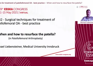 When and how to resurface the patella?