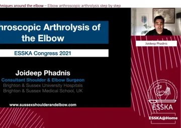 Elbow arthroscopic arthrolysis step by step