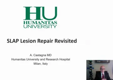 SLAP lesions: Repair