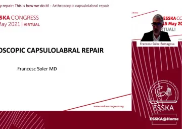 Arthroscopic capsulolabral repair