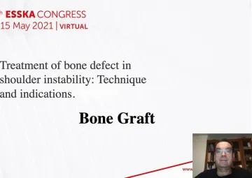 Bone graft