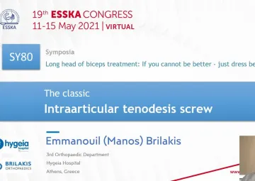 The classic - Intraarticular tenodesis screw