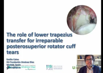 The role of lower trapezius transfer