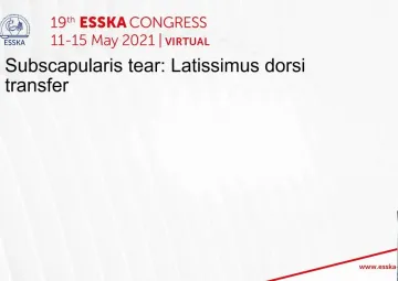 Subscapularis tear: Latissimus dorsi transfer