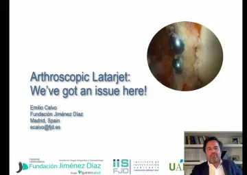 Arthroscopic latarjet: We’ve got an issue here!