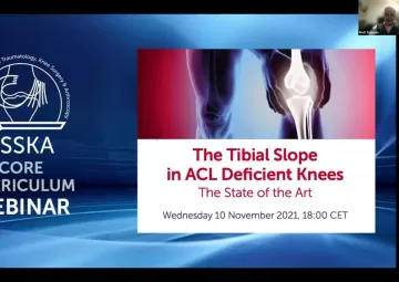 The Tibial Slope in ACL Deficient Knees – The State of the Art