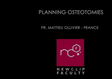 NEWCLIP TECHNICS - Planning Osteotomies